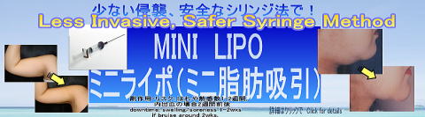 liposonix